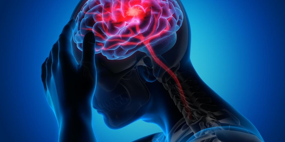 Essential Steps for Stroke Recovery