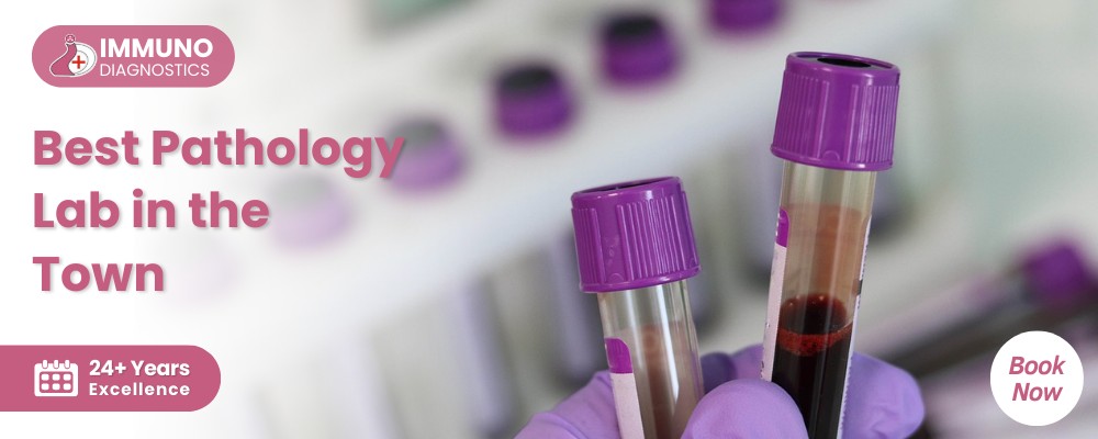 Pathology Lab In East Delhi - Immuno Diagnostics