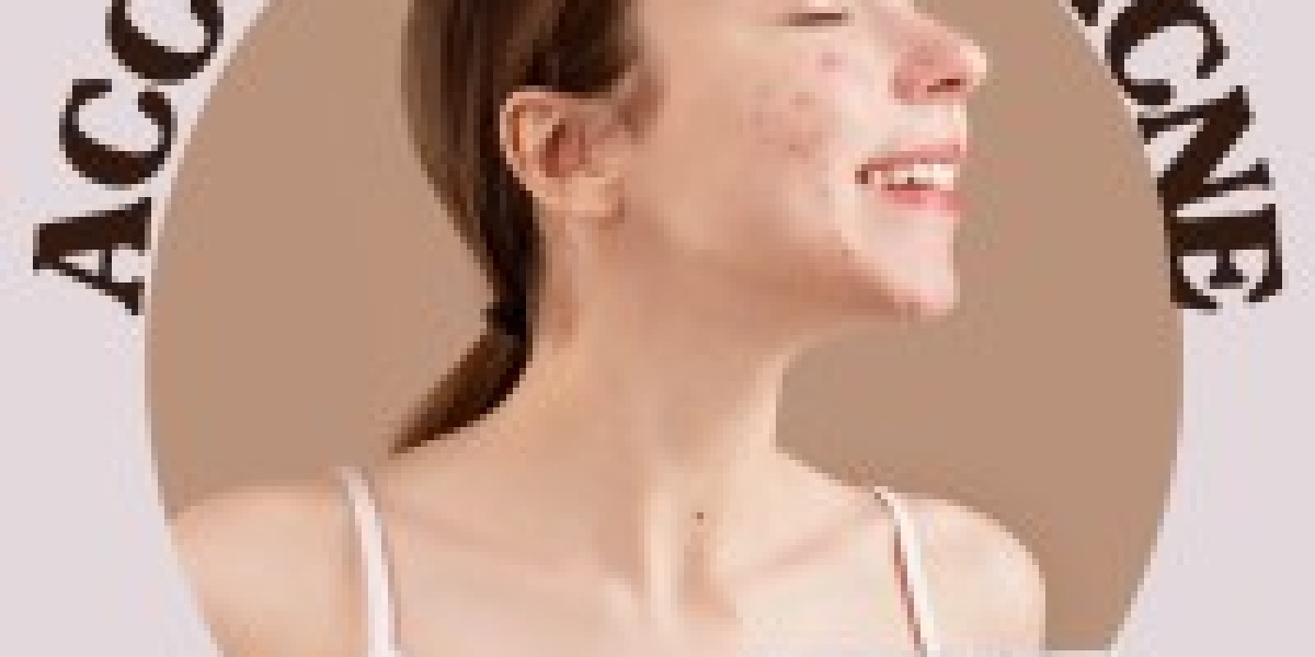 Has your acne come back after taking Accutane?