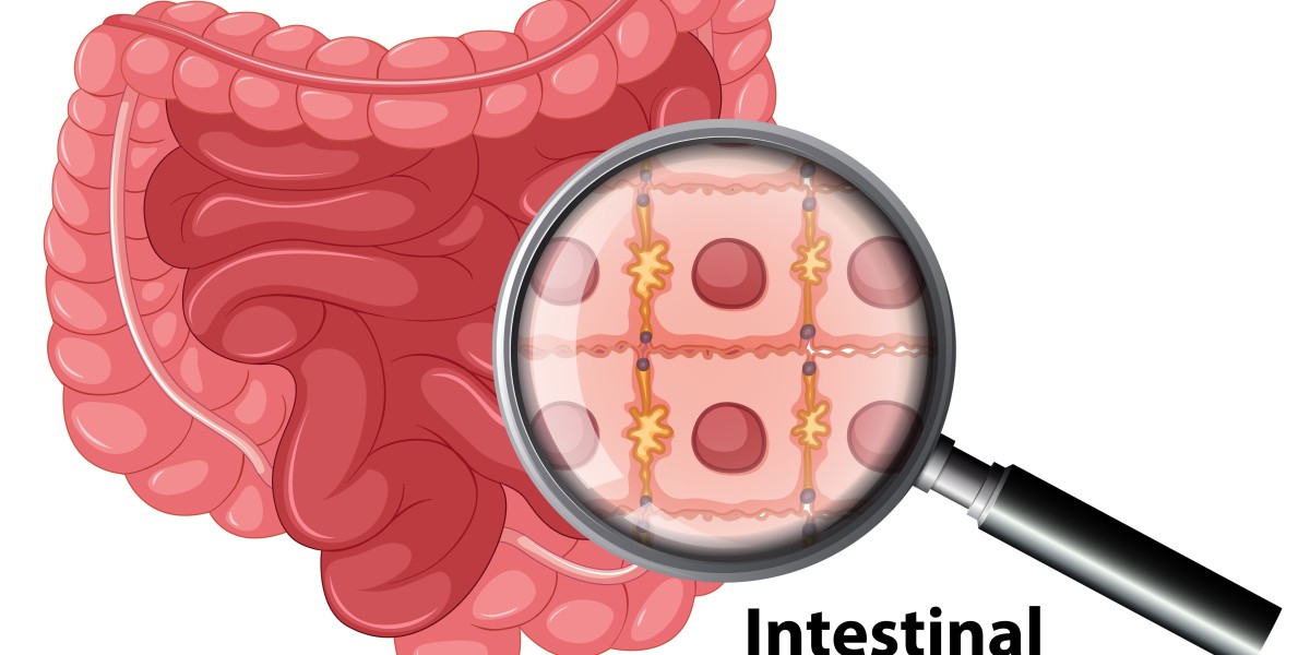Can Homeopathy Heal Your Gut? Discover the Best Remedies!