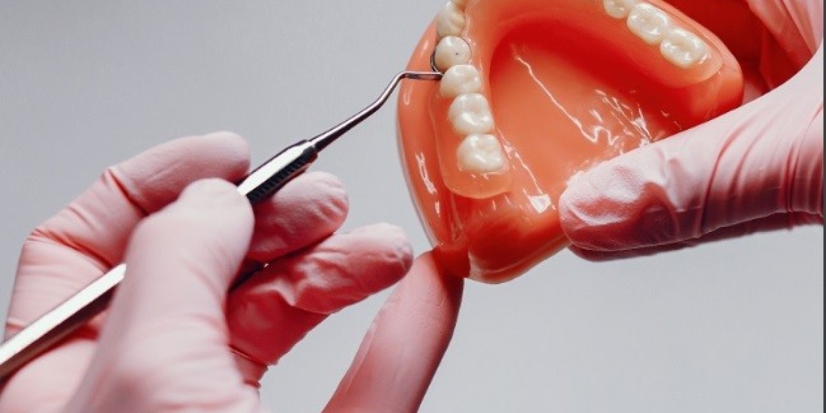 Composite Resin Market Size Insights: Growth Factors and Strategic Approaches of Leading Companies 2031