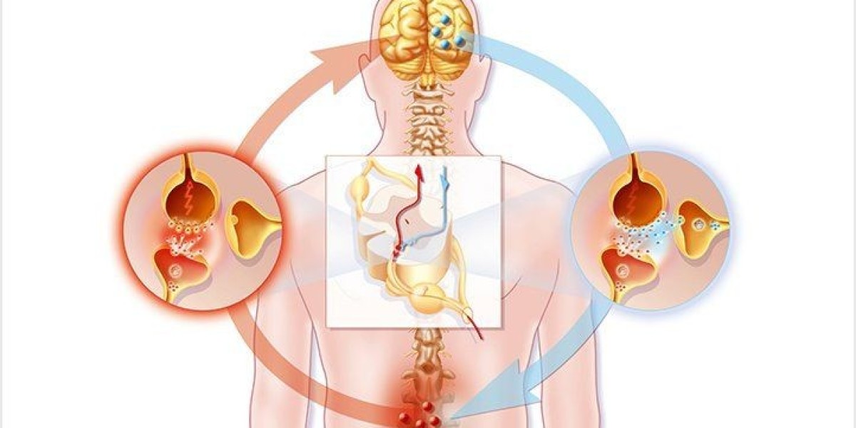 Should You Exercise with Nerve Pain?