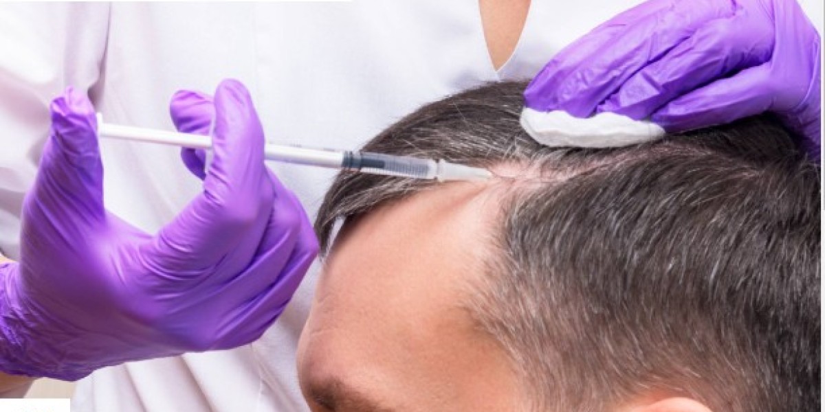 Alopecia Market Generated Opportunities, Future Scope 2023-2031 | Johnson & Johnson Services, Cipla, Merck KGaA