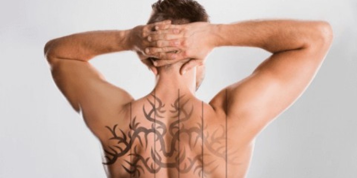 Essential Safety Tips for Successful Laser Tattoo Removal