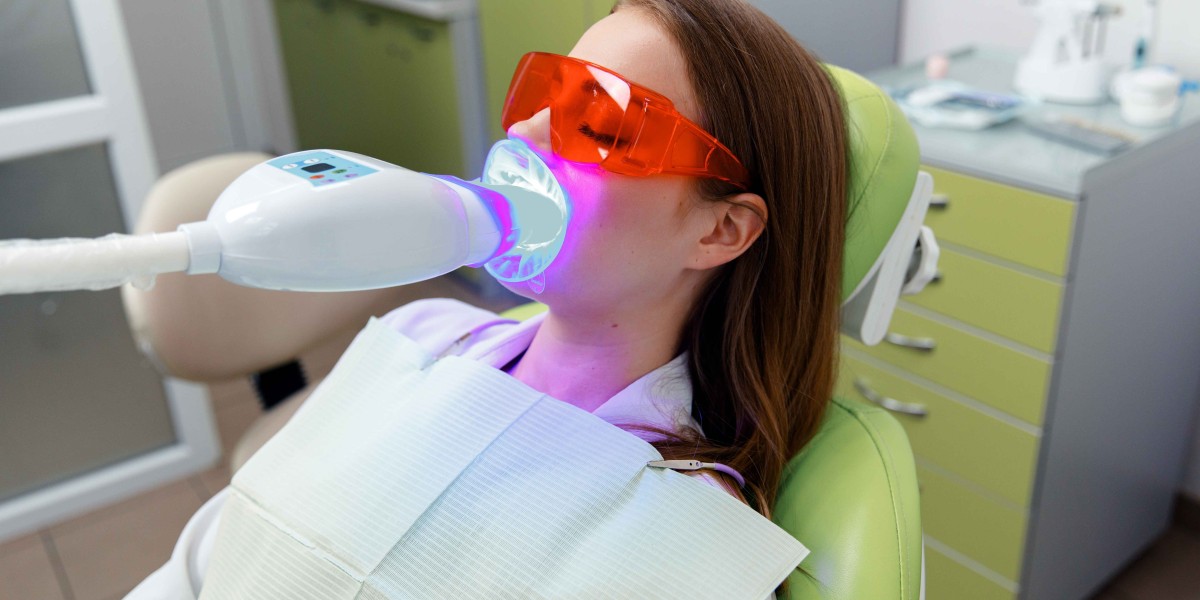 Top Reasons Brits Are Choosing Professional Whitening