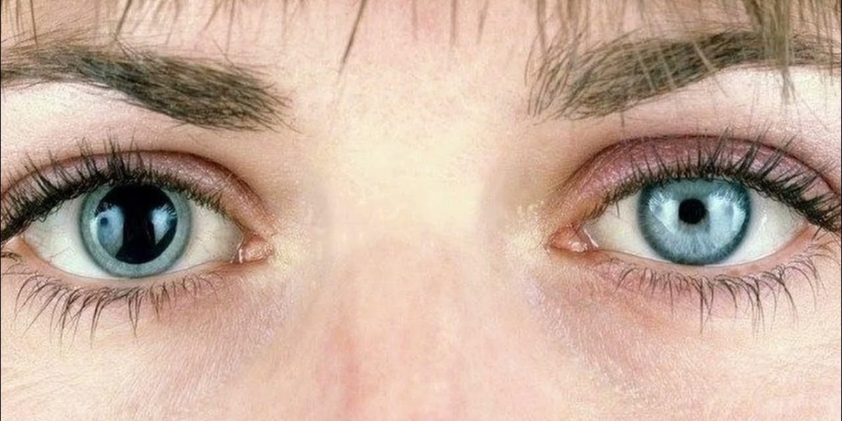 Diagnosis and Symptoms: Causes of Pinpoint Pupils