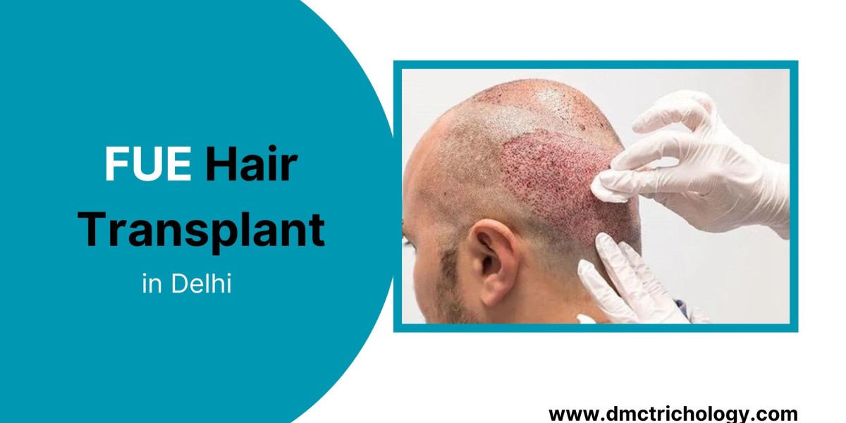 How to Find a Reliable Hair Transplant Clinic for Your Hair Restoration