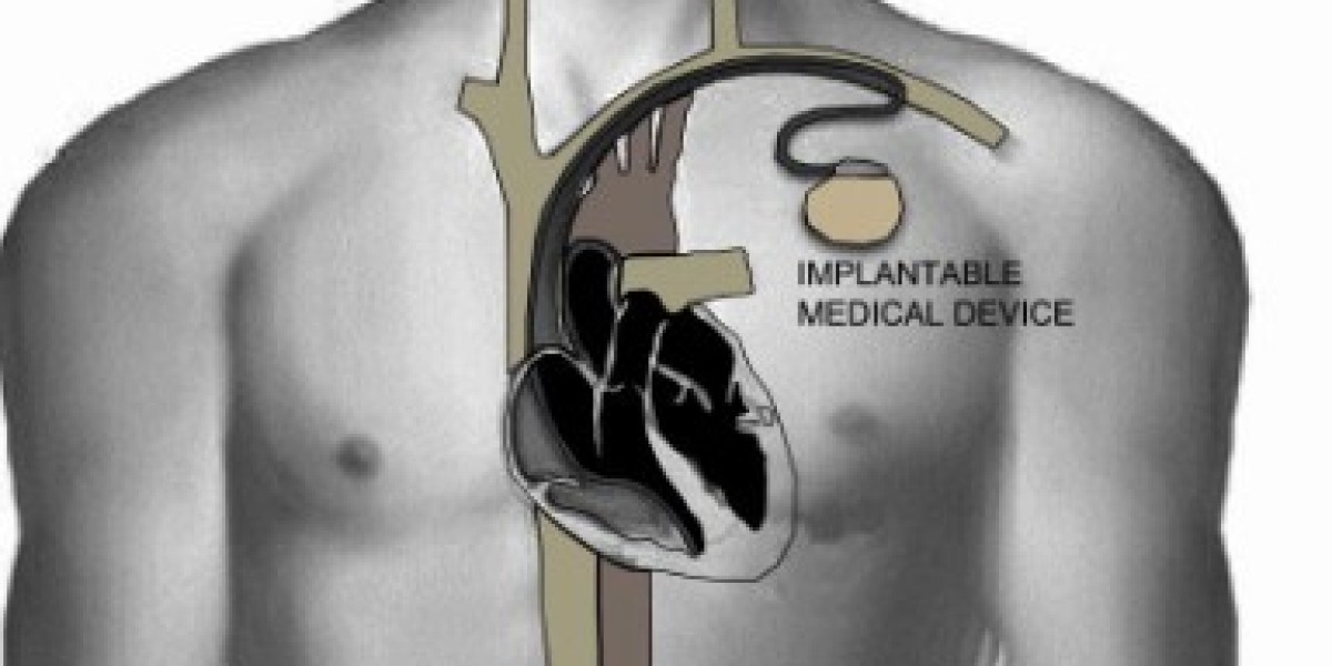 Implantable Medical Devices Market to See Huge Growth by 2030 | Abbott, Boston Scientific Corporation, Danaher Corporati