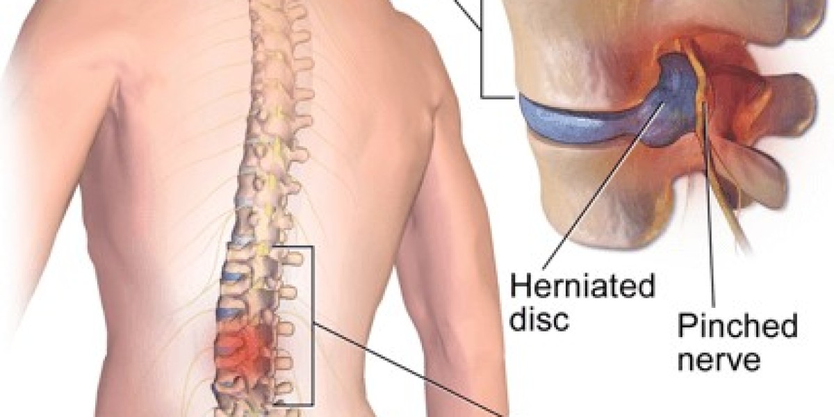 Top 5 Benefits of Aspadol 100 mg for Patients with Moderate to Severe Pain