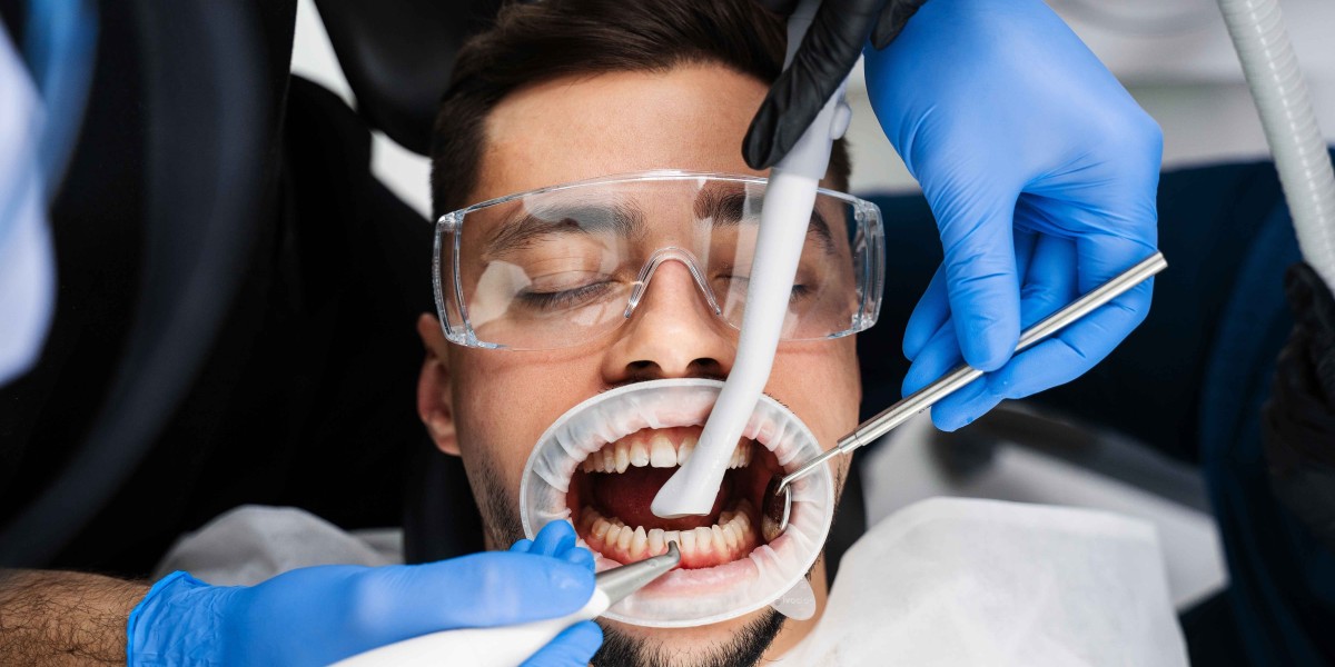 Why Professional Teeth Whitening Is Worth the Investment