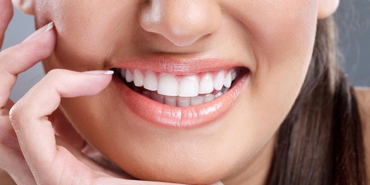 Whitening Your Teeth In London Can Make Your Smile Look Beautiful