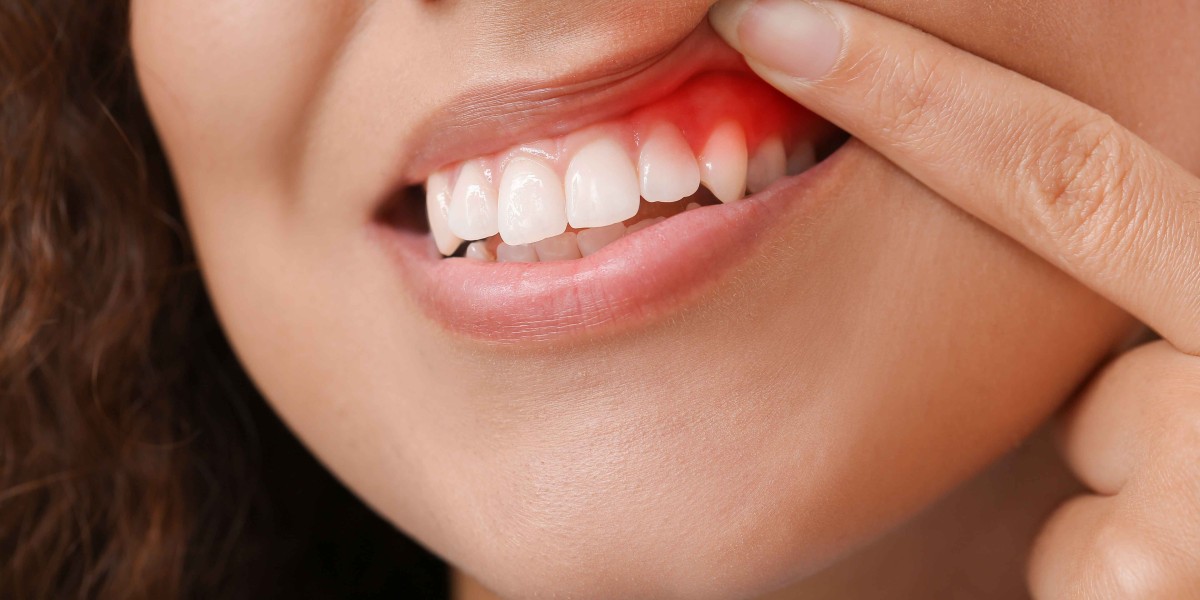 Why Dental and Hygienist Care is Key to Healthy Teeth and Gums