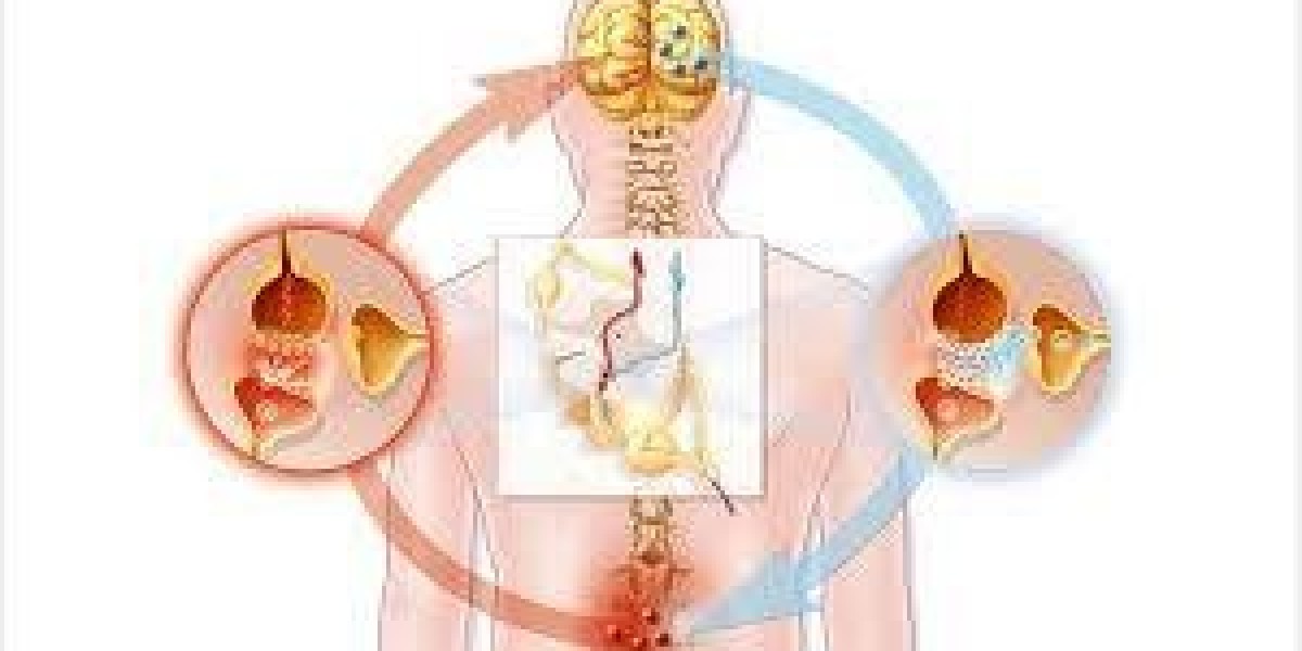 Gabapentin 400 mg: Relief That Actually Works?
