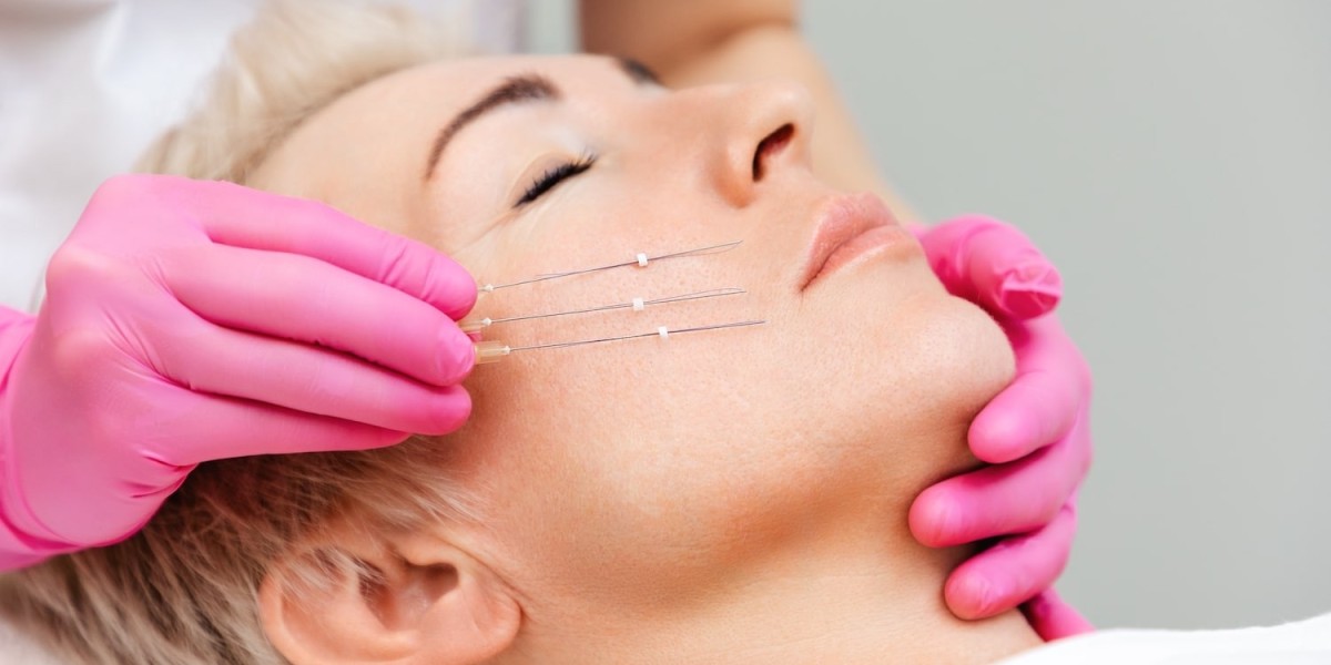 Is Thread Lift Painful? What to Expect During Treatment
