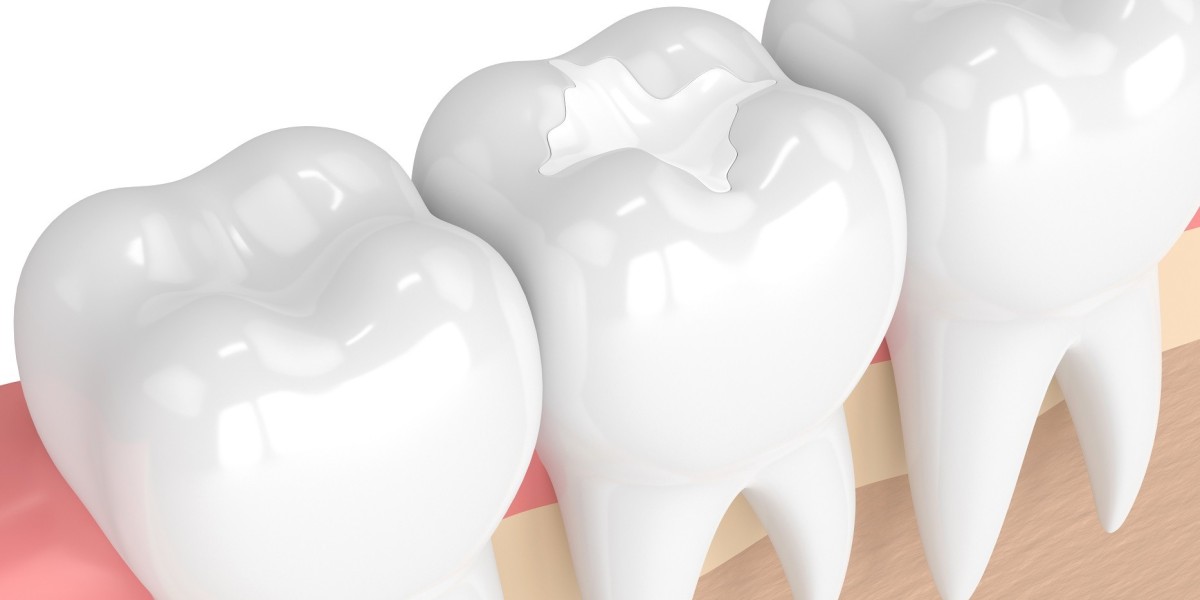 Get Your Smile Back with Expert Restoration Dental Treatments