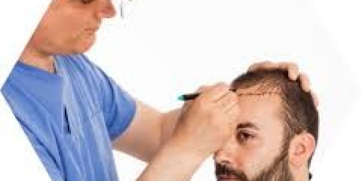 Hair Transplant in Gurgaon & Noida: Expert Care with Dr. Amit Gupta
