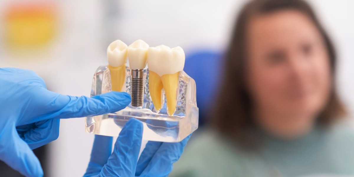 How to Maintain Good Oral Hygiene With Dental Implants