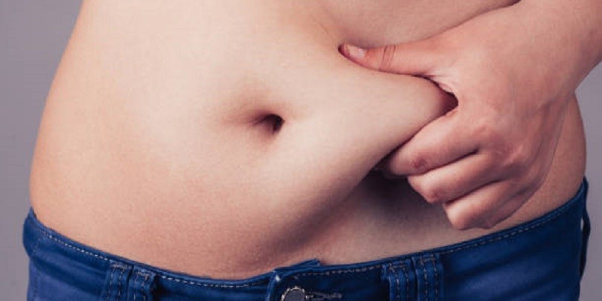 What Is Liposuction? A Complete Guide for Islamabad Residents