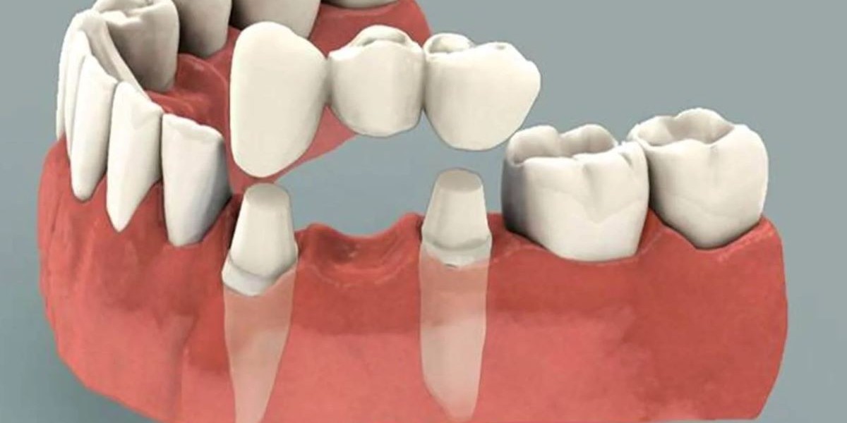 Restore Function and Confidence with Restorative Dentistry