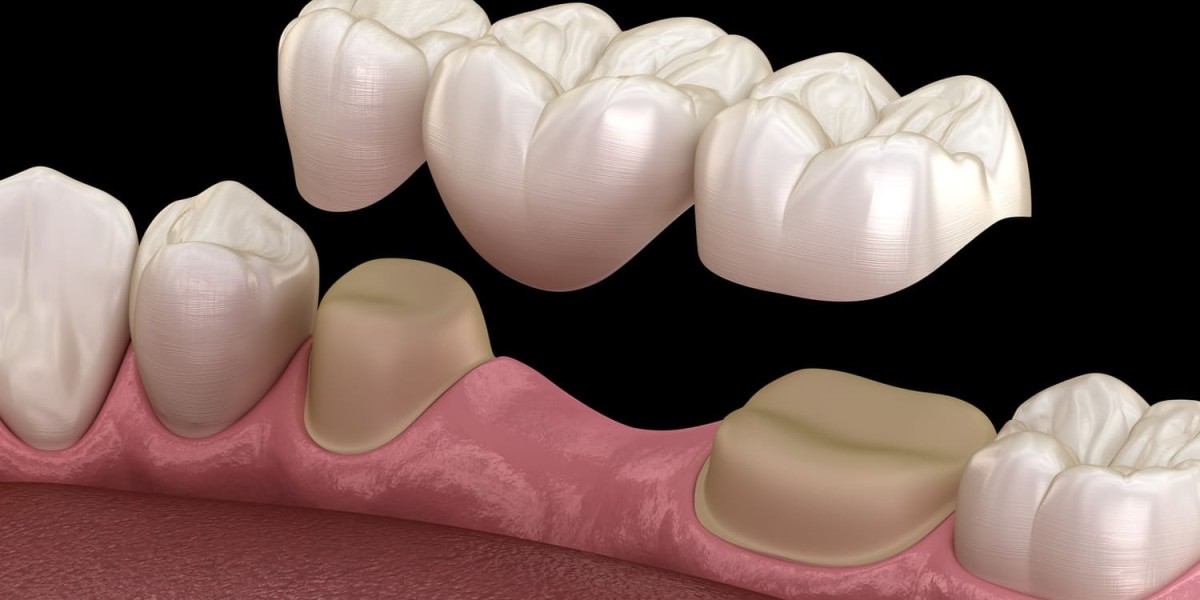 Restore Function and Confidence with Restorative Dentistry