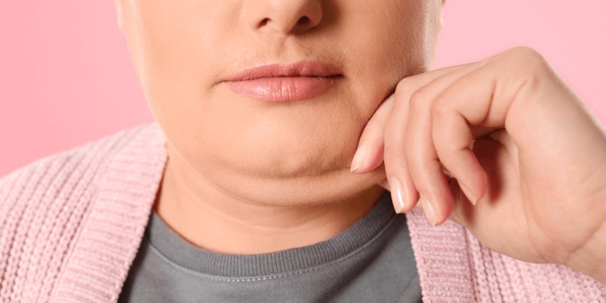 Double Chin Removal: Affordable Options That Actually Work