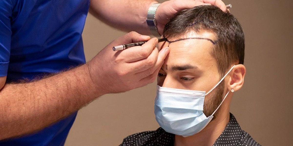 The Science Behind Hair Transplantation in Islamabad