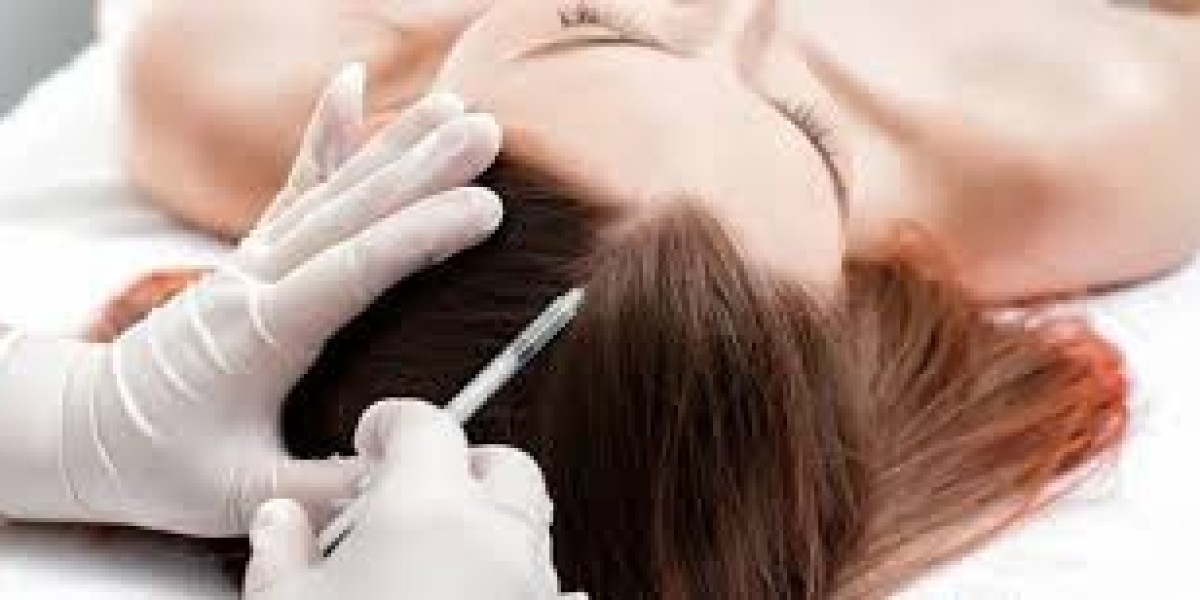 Combining PRP with Other Hair Loss Solutions: The Ultimate Treatment Plan