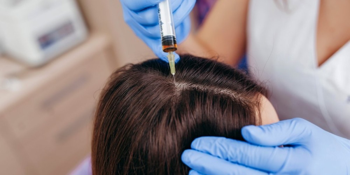 How PRP Hair Treatments Can Delay the Need for a Hair Transplant