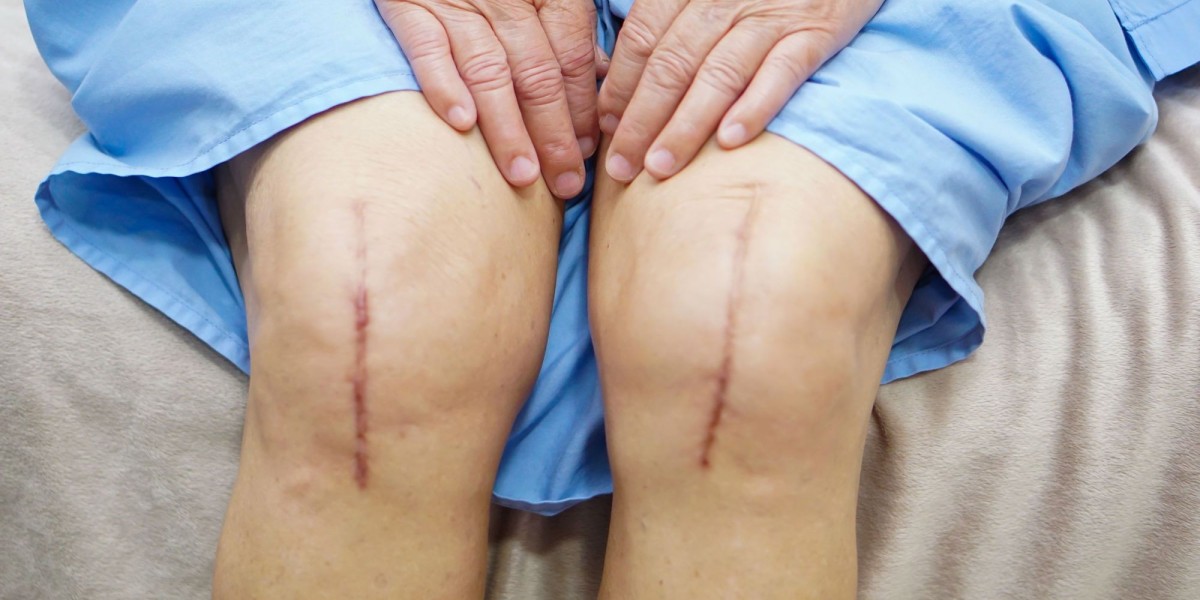 Your Guide to Preparing for a Successful Knee Surgery