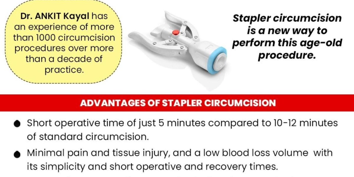 Laser Treatment for Kidney Stones: Is It Right for You?