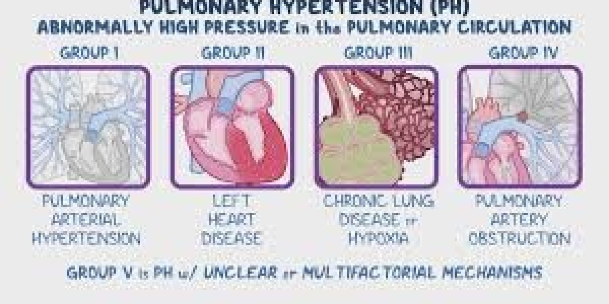 A Deep Dive into Pulmonary Hypertension