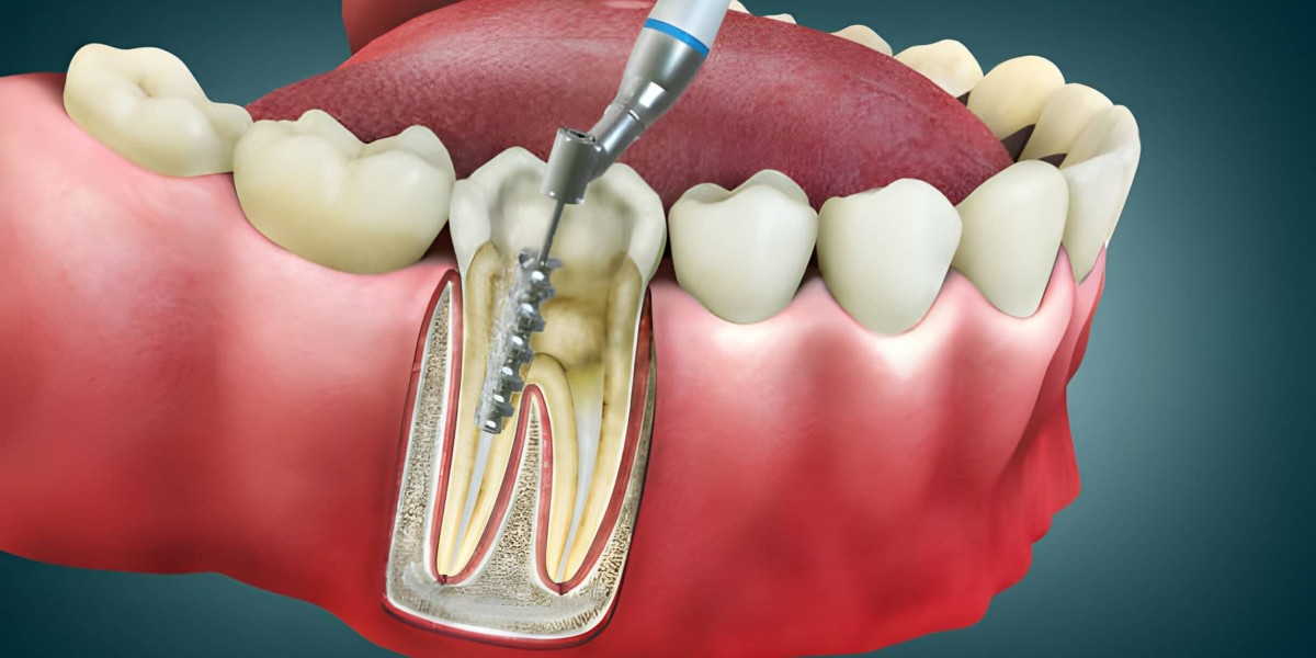 Restore Your Smile and Function with Modern Dental Treatments
