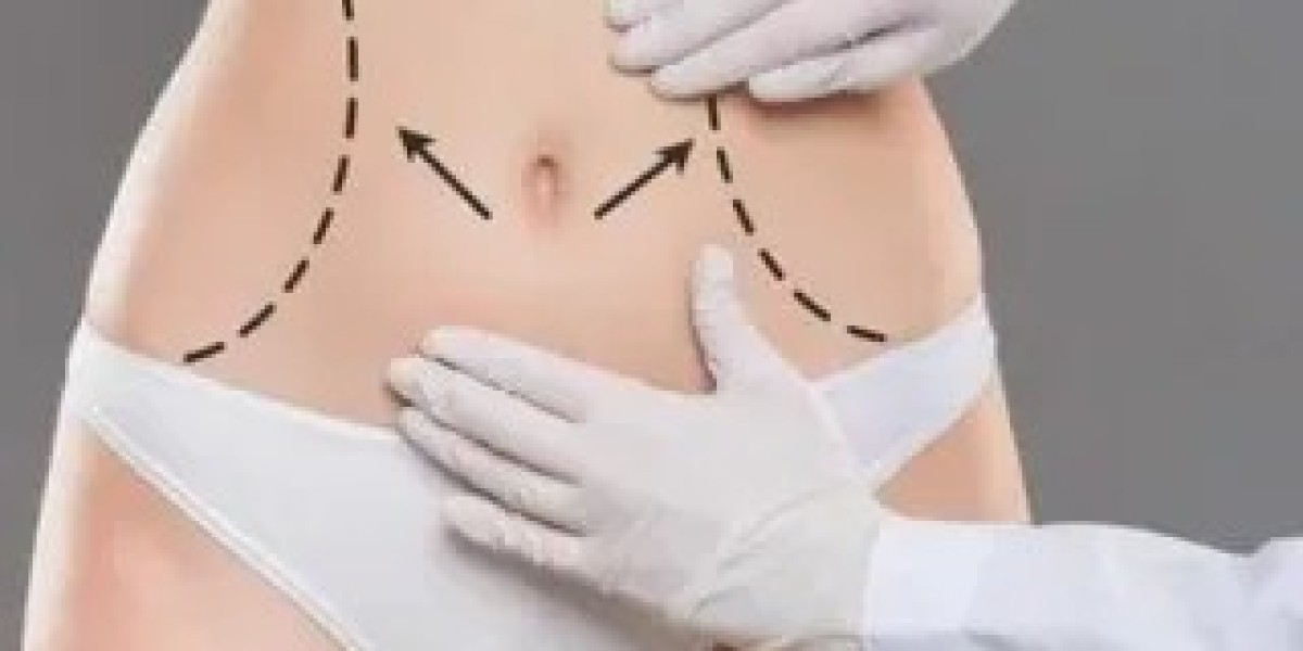 Tummy Tuck Surgery for Men: Why Islamabad Clinics Are Seeing More Male Patients