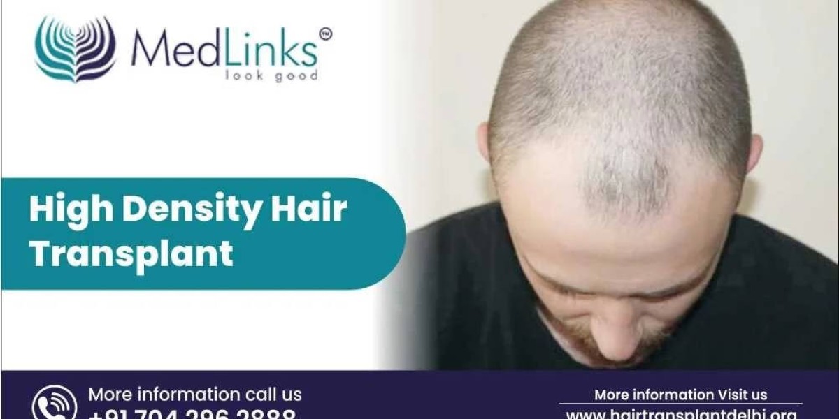Trusted for Best Hair Transplant Results in India