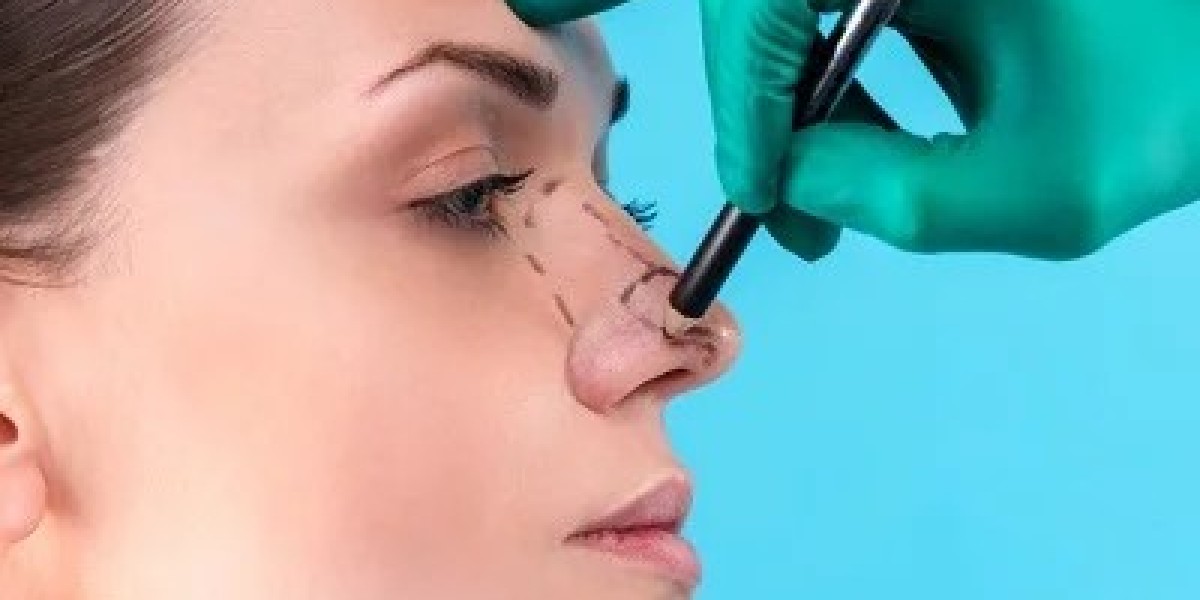 What Should I Ask During My First Rhinoplasty Consultation in Dubai