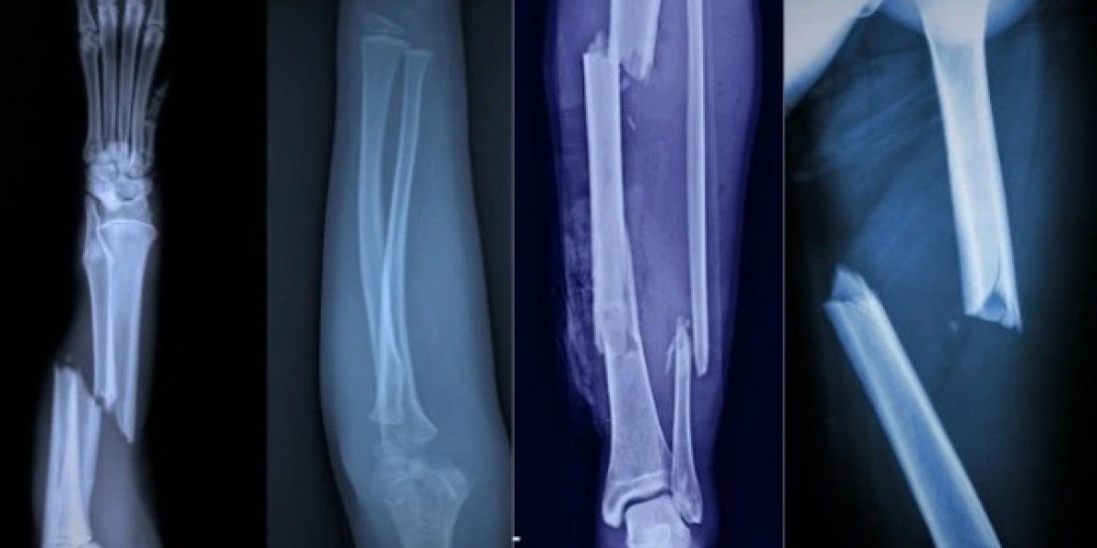 Best Complex Trauma Doctors in Kolkata – Dr. Reet Mukhopadhyay Offers Expert Surgical Solutions for Severe Fractures and
